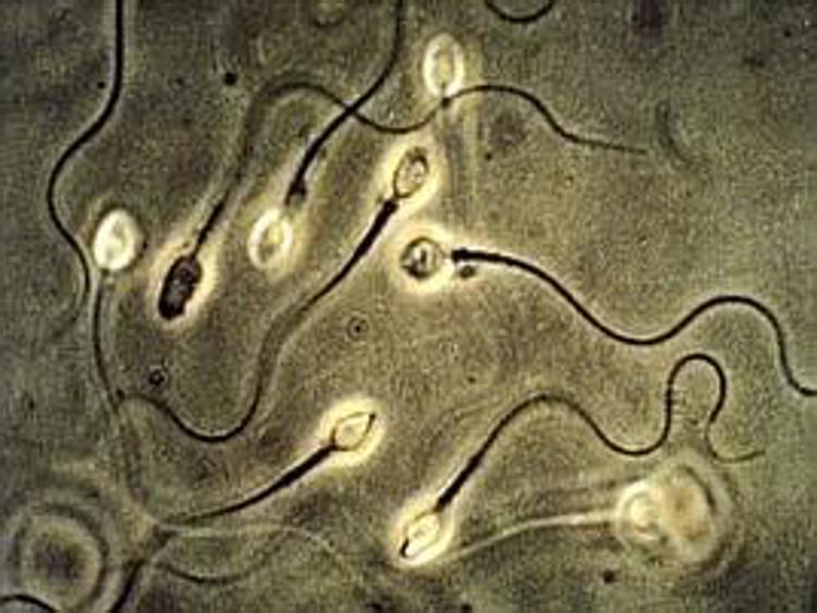 Spermatozoi in vitro, l'esperto: 