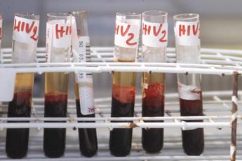 Aids, un’iniezione due volte all’anno può prevenire l’Hiv