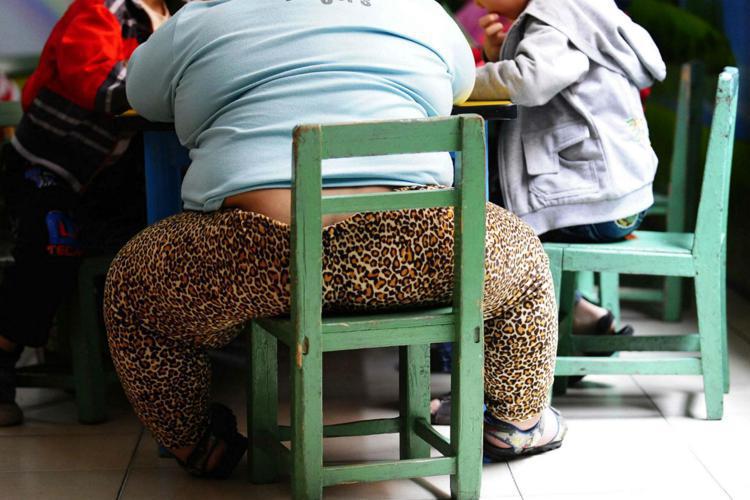 Obesità - cambiano i criteri per diagnosi e cura della malattia