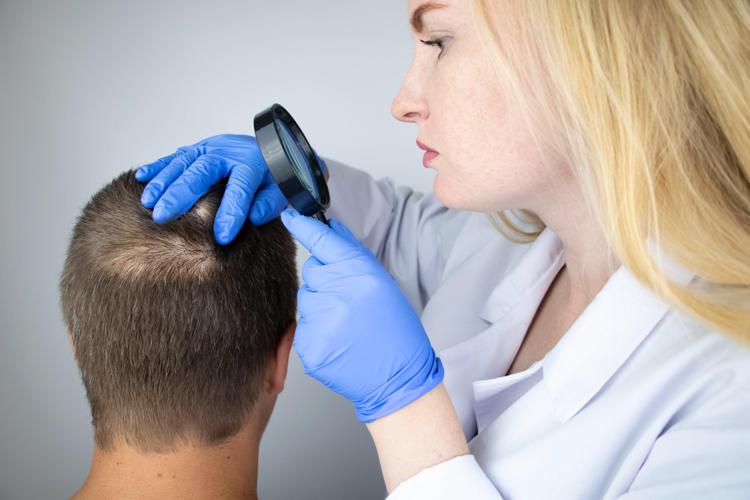 Contributi parrucca e banca dei capelli, il Lazio vicino ai pazienti affetti da alopecia