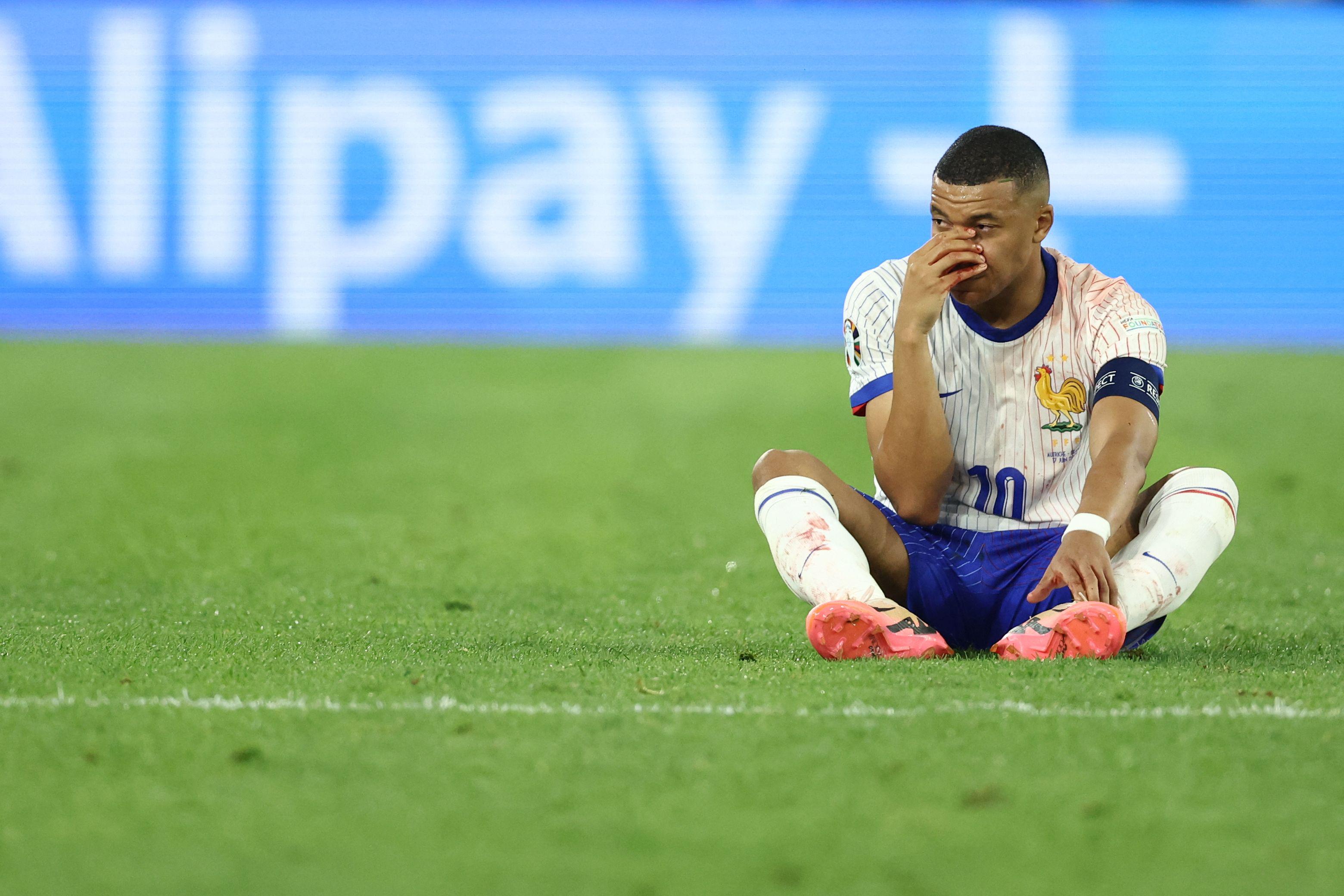 Mbappé e la frattura al naso - per ora il capitano della Francia non si opera