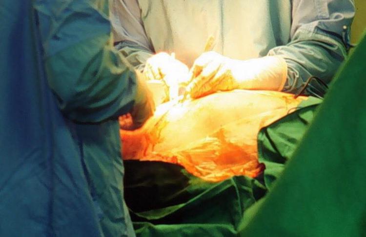Un intervento chirurgico (Fotogramma)