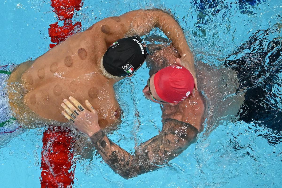 Coppettazione aiuta nel nuoto alle Olimpiadi 2024? I medici: Non ha basi scientifiche