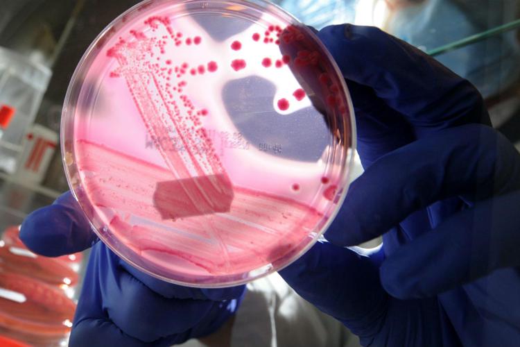 Il batterio dell'Escherichia coli - (Fotogramma)