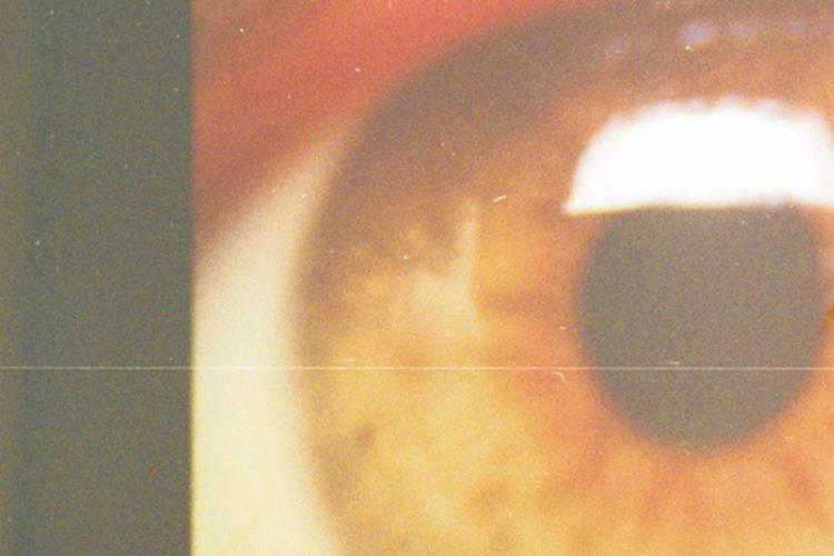 Rilancio Holostem, terapia salva-cornea a 1 paziente e già altri in lista