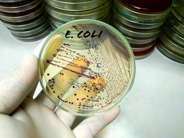 Da salmonella a listeria a E.Coli, ipotesi in campo in tossinfezioni alimentari