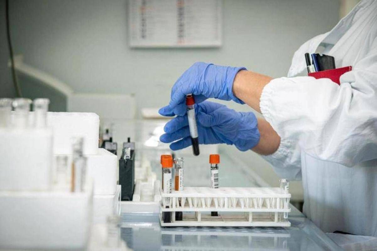 <div>Aids, al Croi 2025 primi dati su PrEP da somministrare 1 volta l'anno</div>